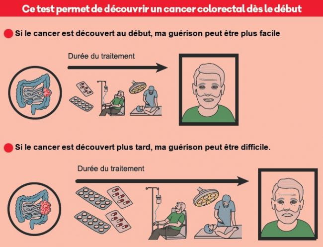 Dépistage du cancer colorectal - Mars Bleu : faites le test ! - Ville de Stains